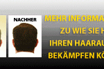Uhrzeitumstellung und Haarausfall