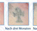 Die Uhrzeitumstellung von der Winter- auf die Sommerzeit und vice versa